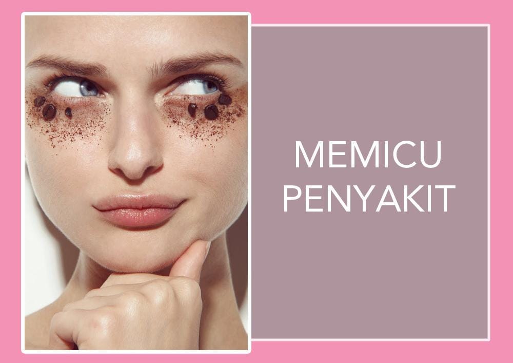 Photo: jamienelsonphoto.blogspot.co.id/Jamie Nelson For Vogue