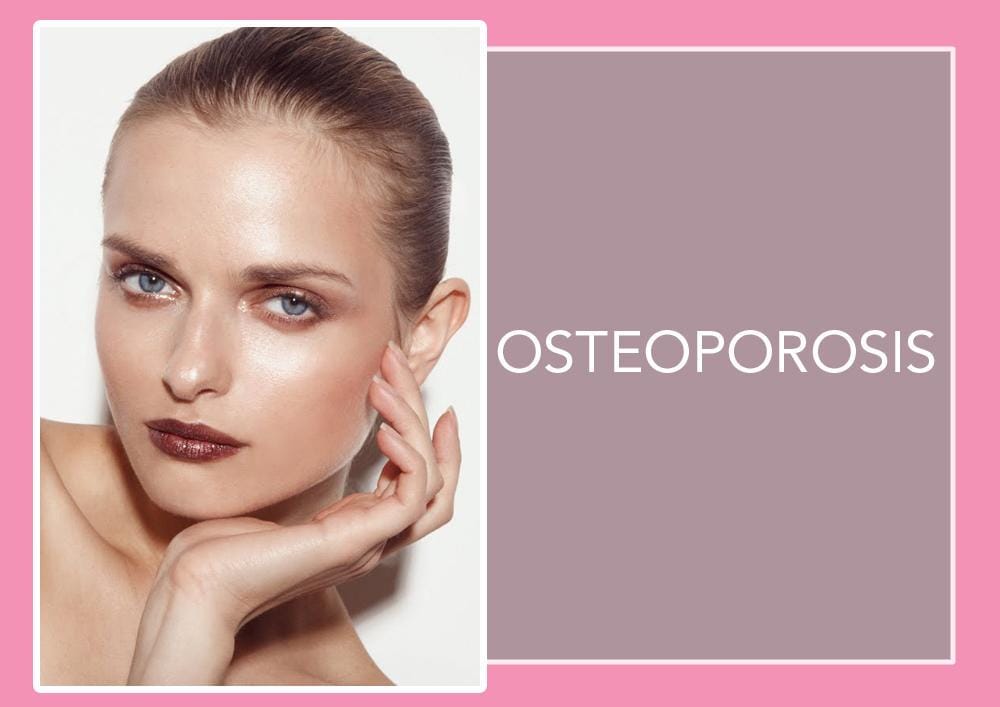 Photo: jamienelsonphoto.blogspot.co.id/Jamie Nelson For Vogue