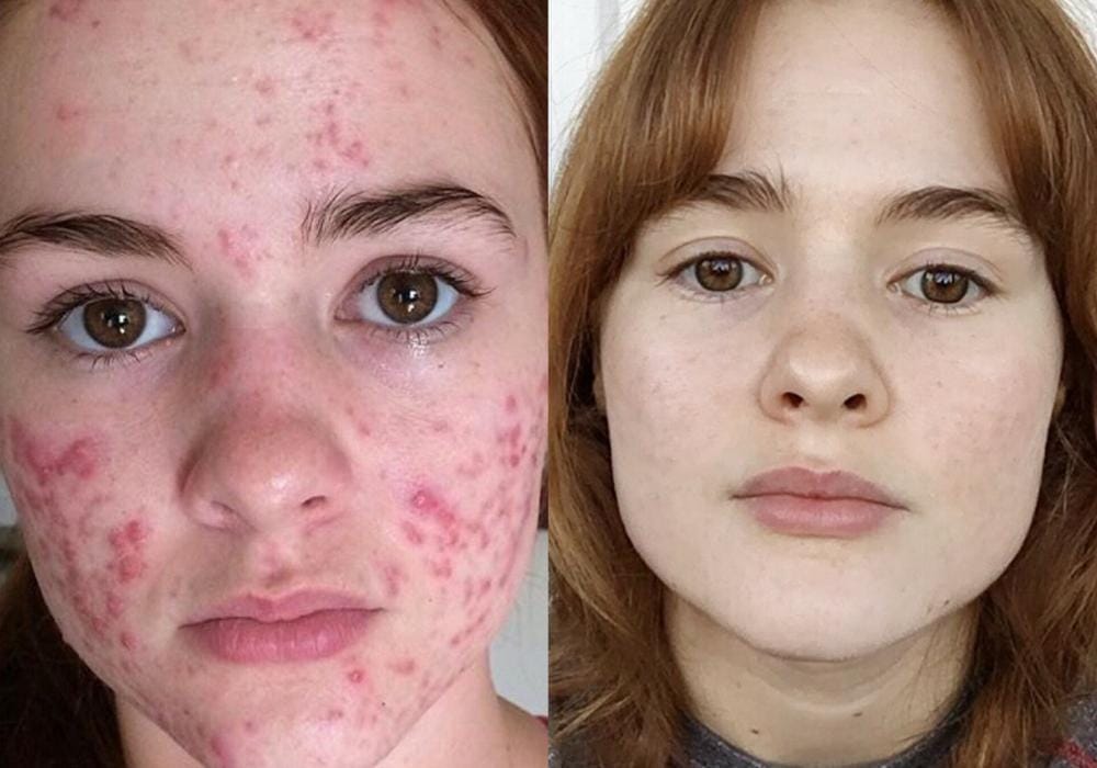 Instagram.com/myfacestory