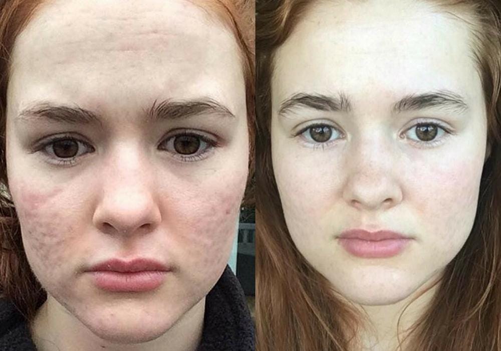 Instagram.com/myfacestory