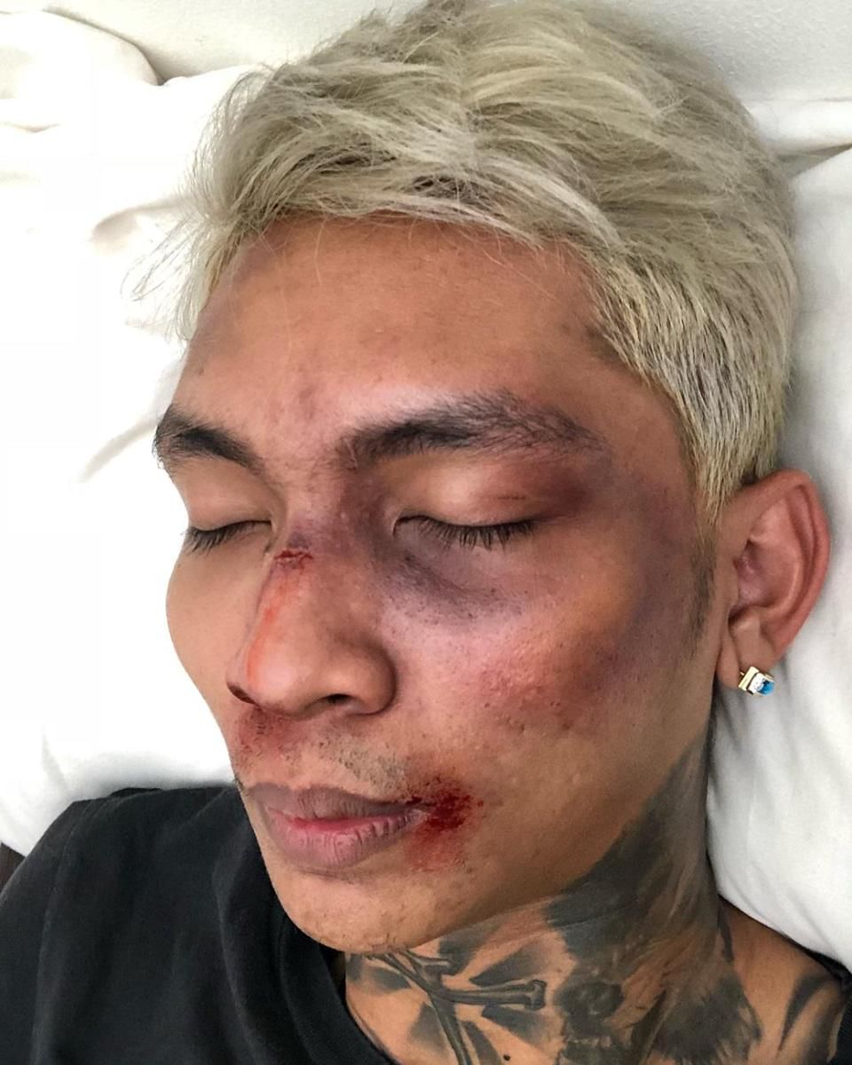 instagram.com/young_lex18