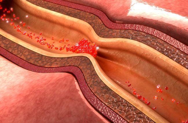 Health.clevelandclinic.org