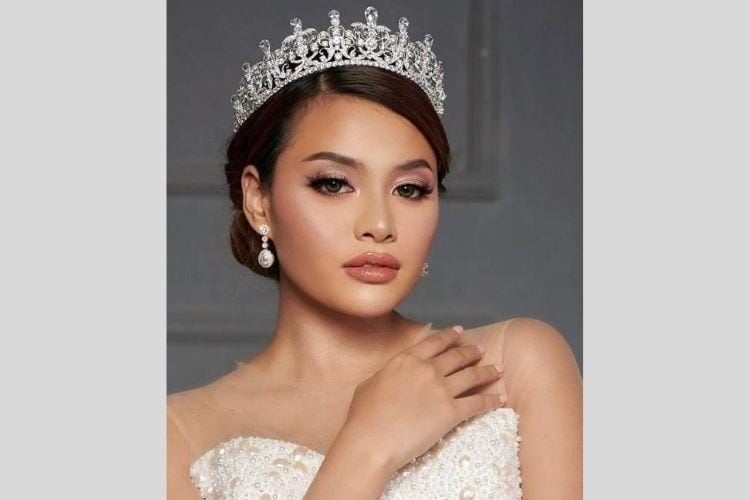 9 Potret Transformasi Aurel Hermansyah dari Kecil Hingga Sekarang