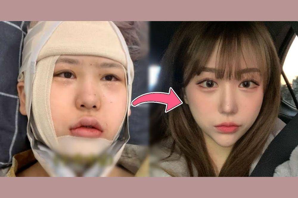 koreaboo.com