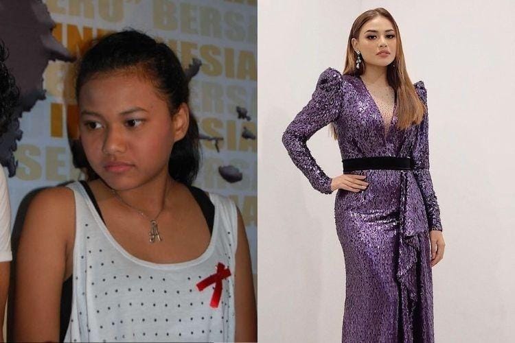 Gaya Artis Indonesia Sebelum vs Sesudah Terkenal, Pangling Banget!