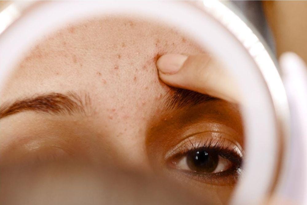 Tips Memilih Sunscreen Sesuai Jenis Kulit /pinkvilla.com