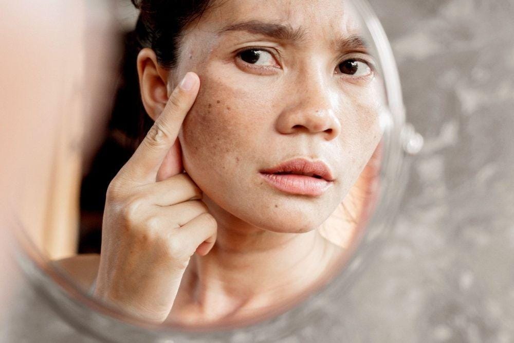 Macam-macam Diet untuk Berbagai Jenis Kulit/ webmd.com