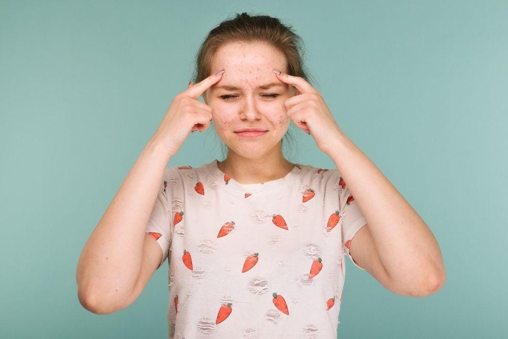 Bahaya Sering Memencet Jerawat, freepik.com