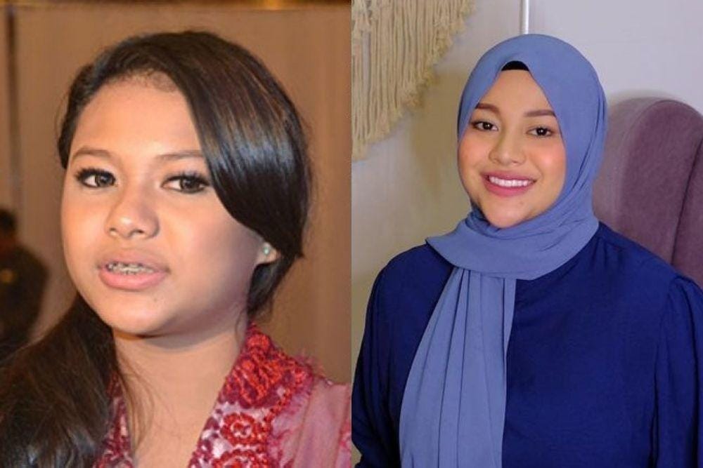 doc.internet, instagram.com/aurelie.hermansyah