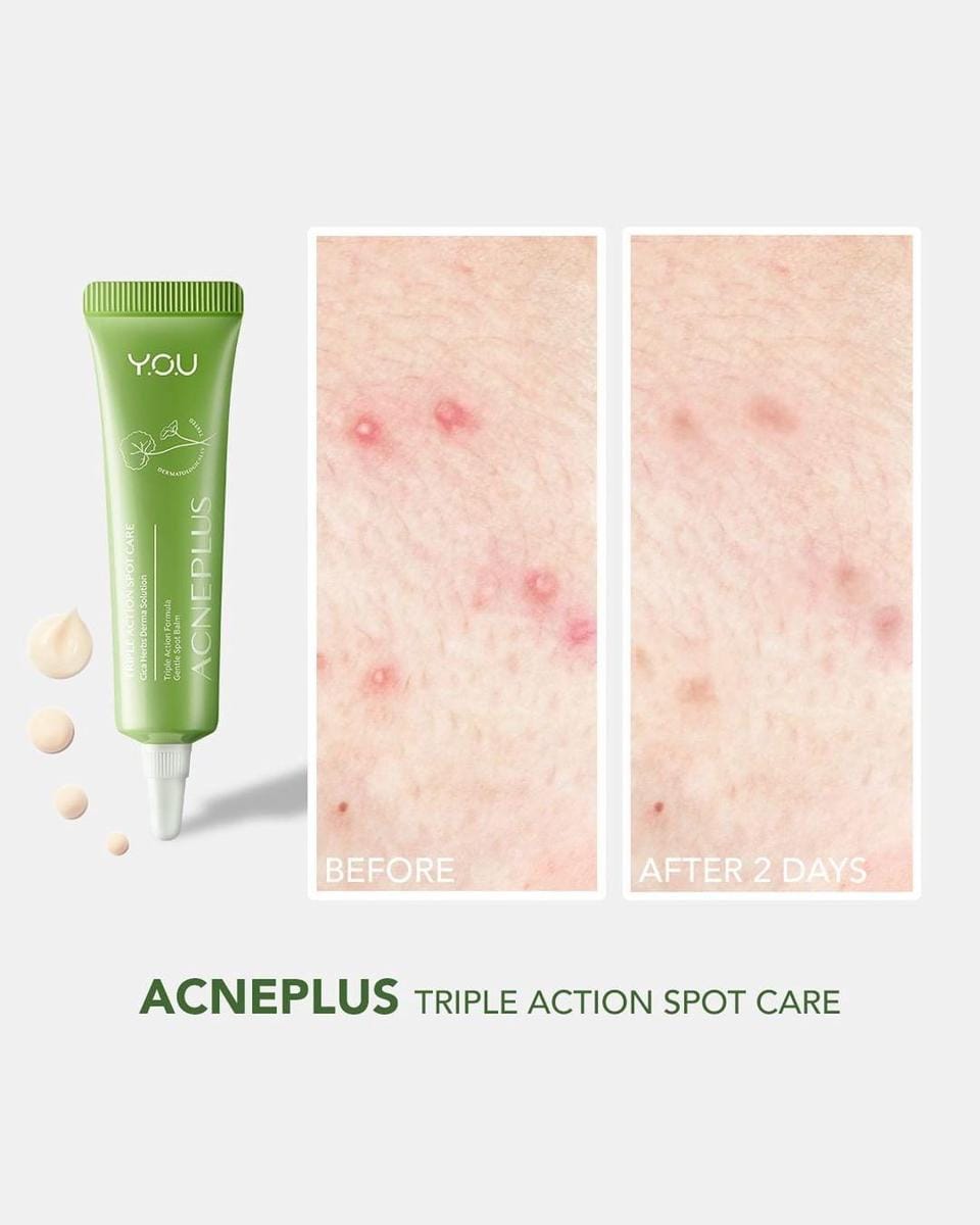 instagram.com/youbeauty_idn