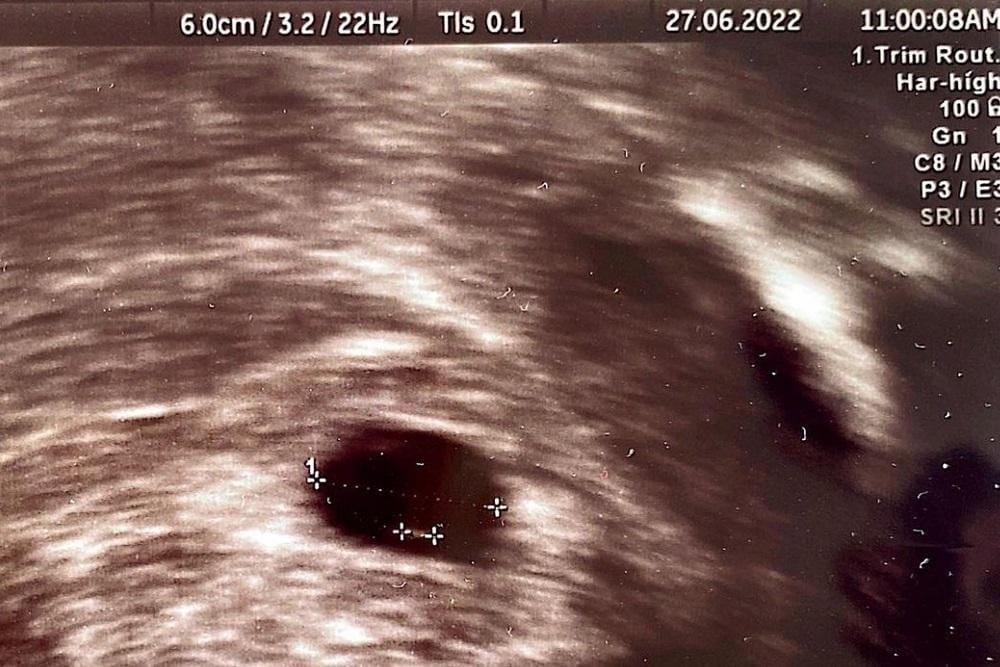 Instagram.com/annisayudhoyono