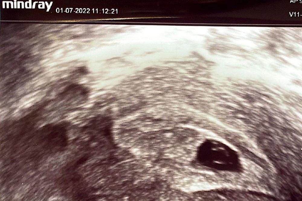 Instagram.com/annisayudhoyono